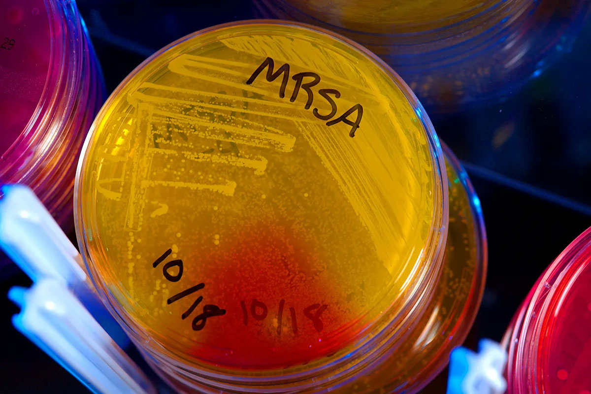 holmes mrsa 053121